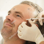 stock-photo-middle-aged-male-client-during-filler-injections-in-aesthetic-medical-clinic-2074855885