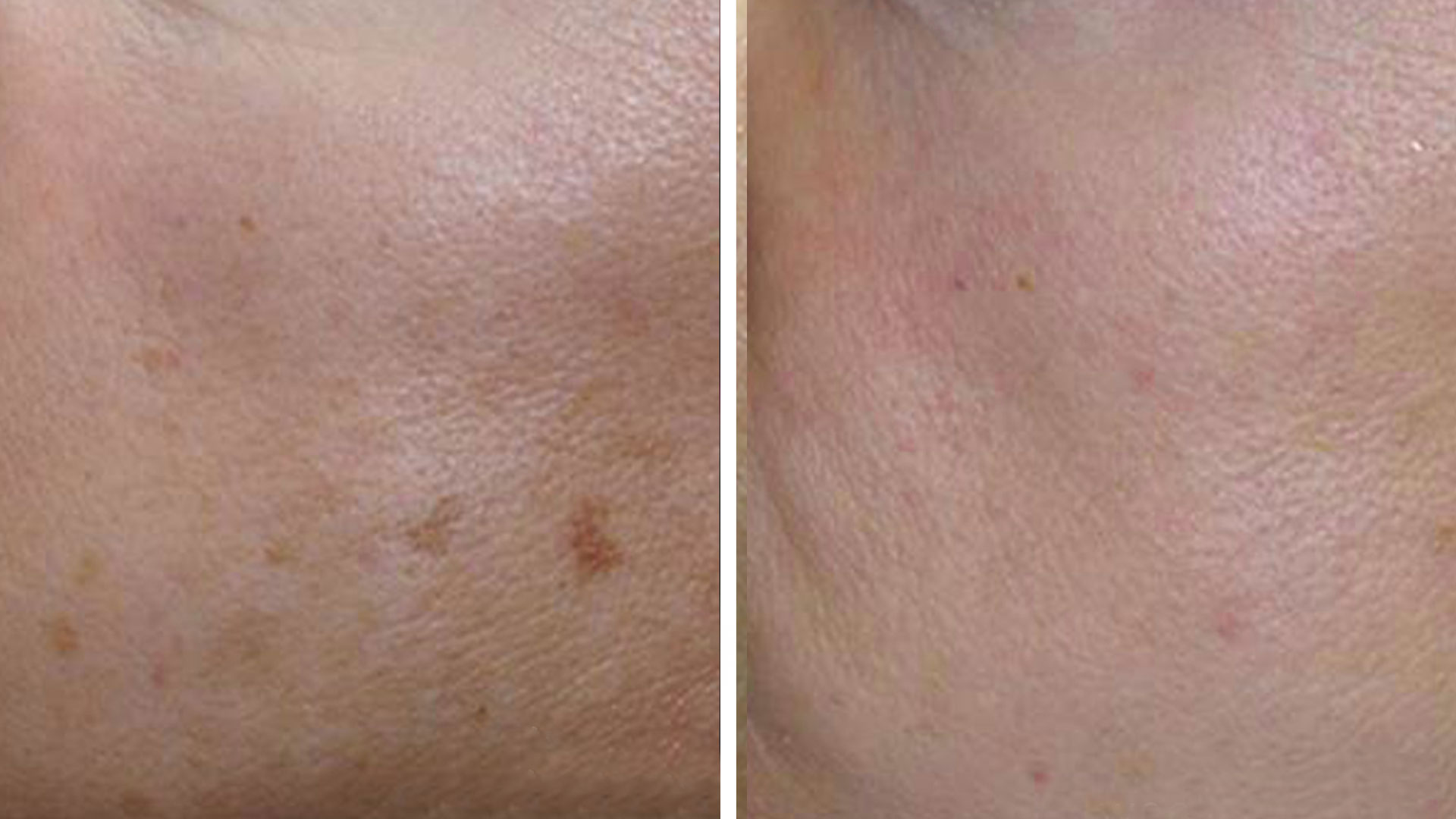 Lasers Special Kopelson Clinic