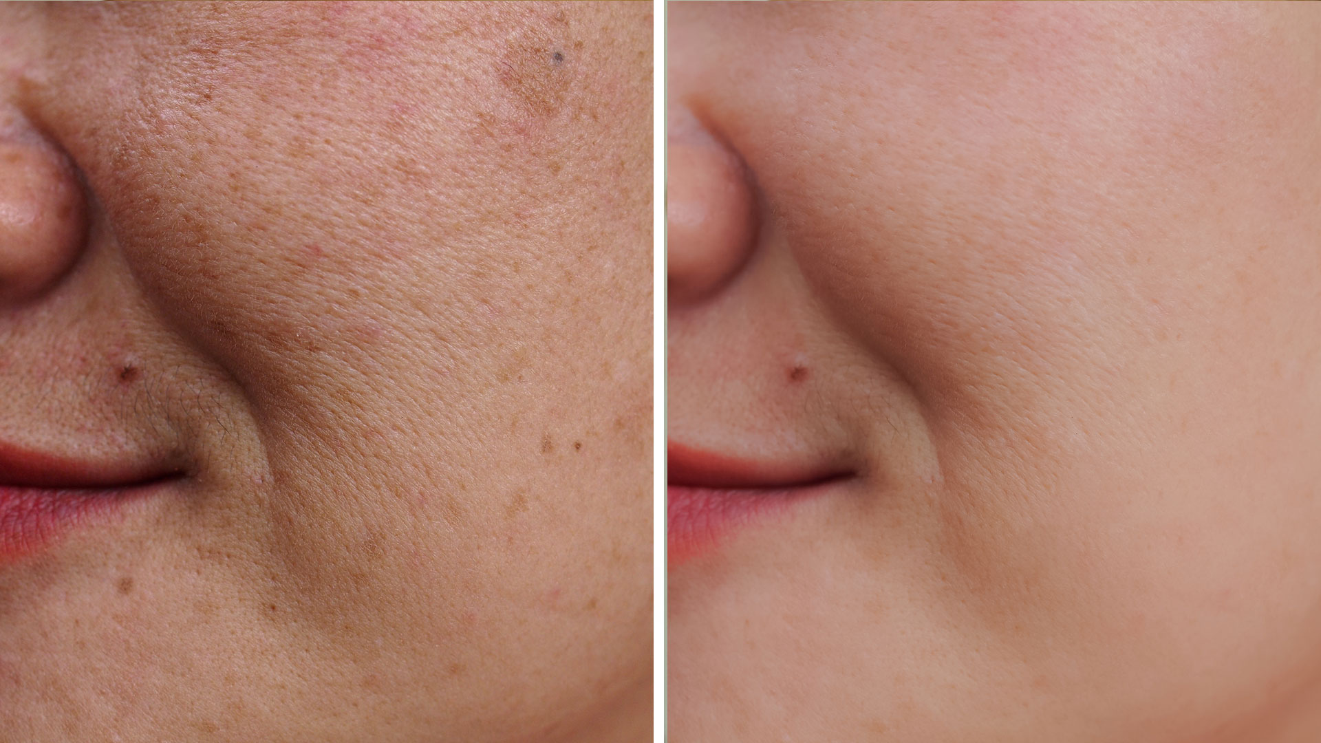 Lasers Special Kopelson Clinic